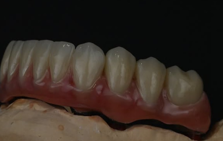 Bite 2