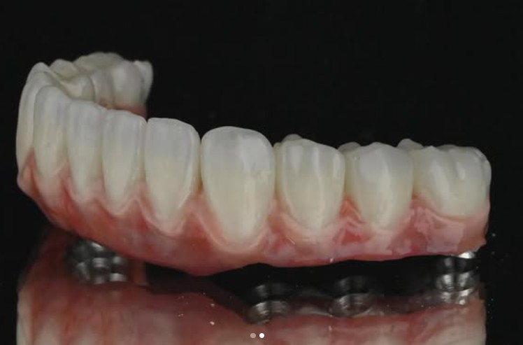 Zirconia / Zircon Ceramic 1