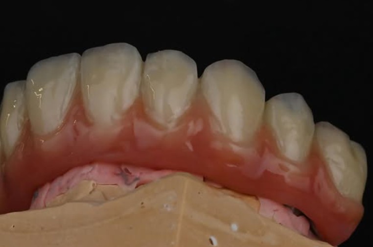 Zirconia / Zircon Ceramic 2