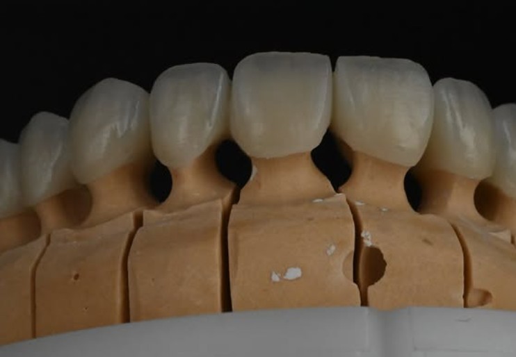 Zirconia / Zircon Ceramic 3